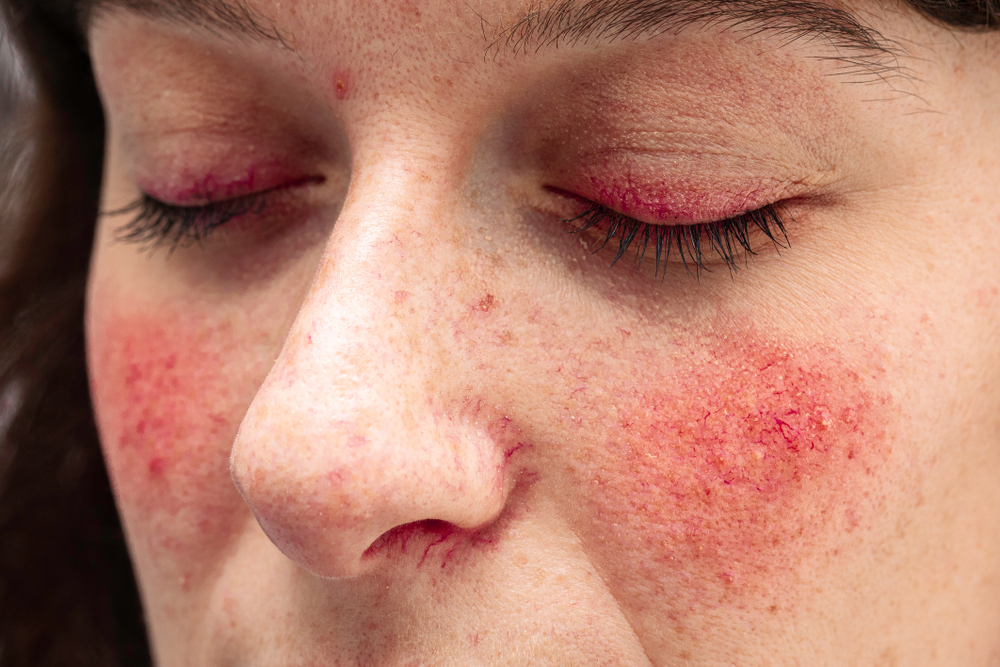 Como Montar uma Rotina de Skincare Suave para Pele Reativa