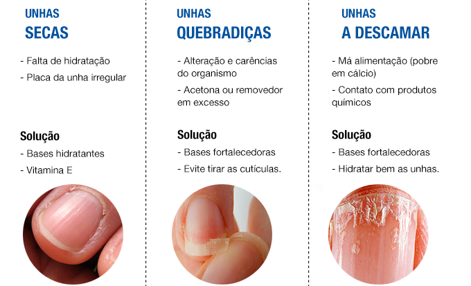 dicas para unhas não amarelarem