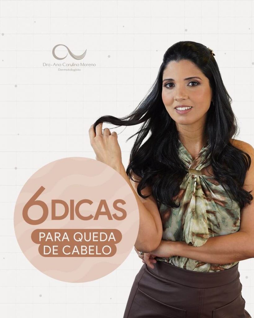 Como Escolher o Produto Ideal para o Seu Tipo de Calvície - inspiração 2