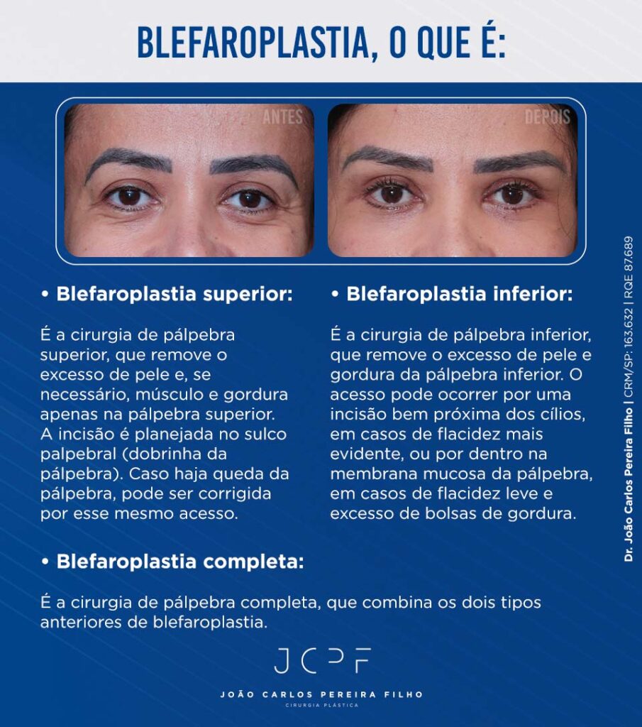 dicas para um olhar mais aberto e descansado