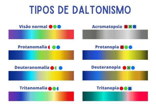 Causas do daltonismo genético