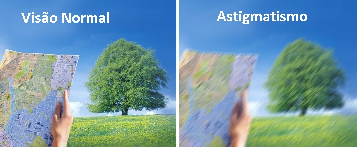 o que é astigmatismo na visão