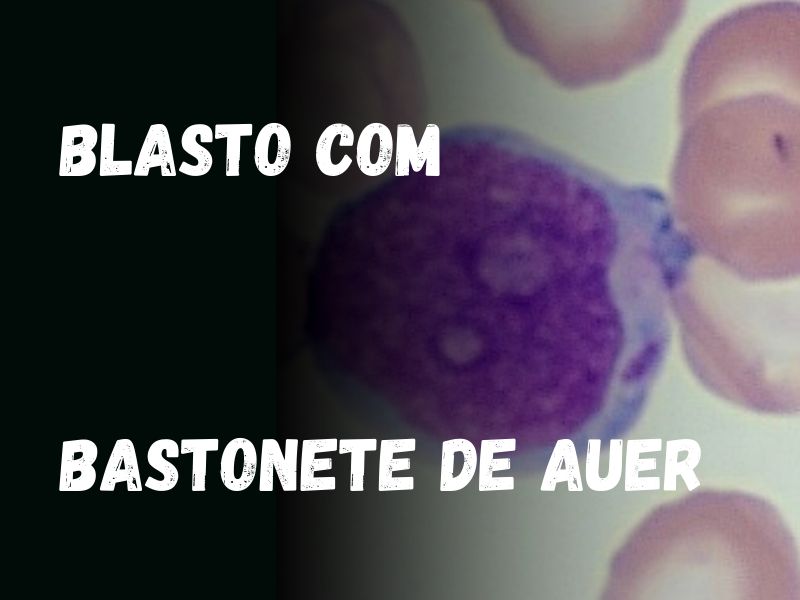o que são bastonetes no exame de sangue e seus níveis normais