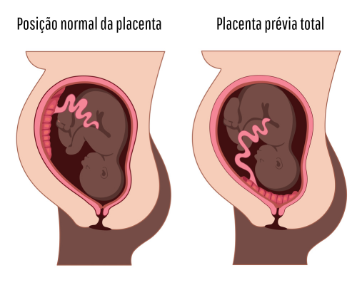 o que é placenta