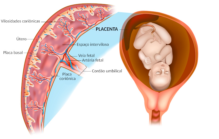 erros comuns na interpretação do exame de placenta
