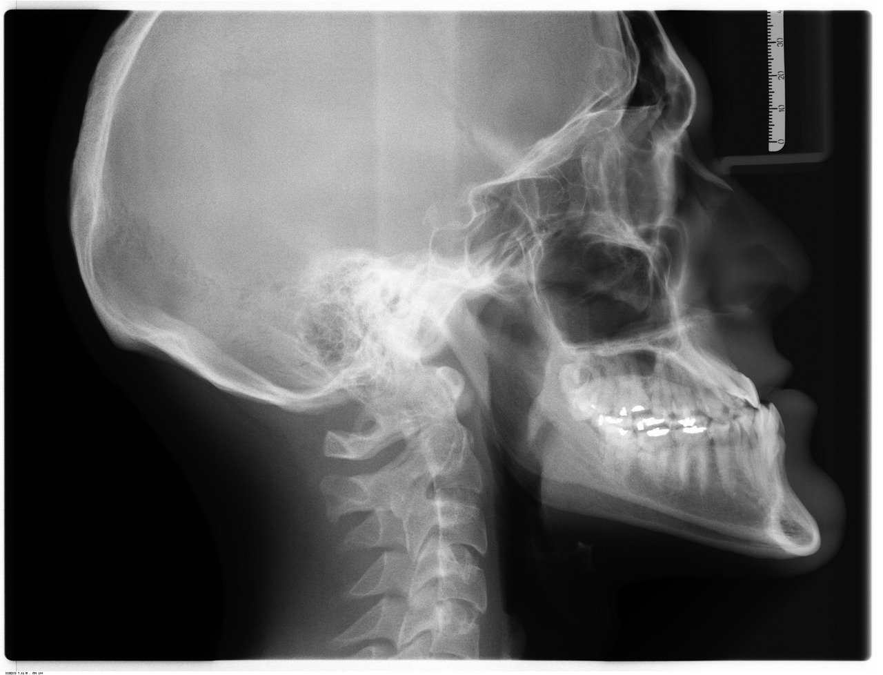 técnico em radiologia