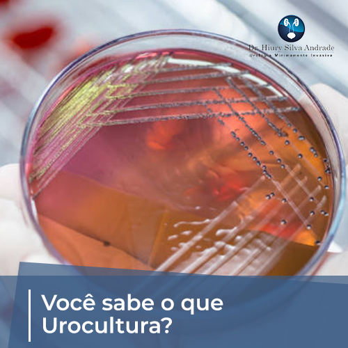 urocultura com antibiograma