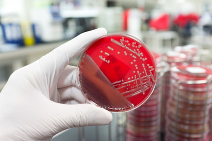 exame de urina para infecção