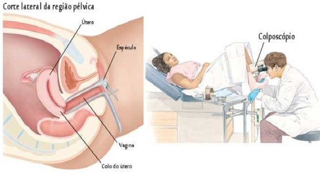 exame preventivo