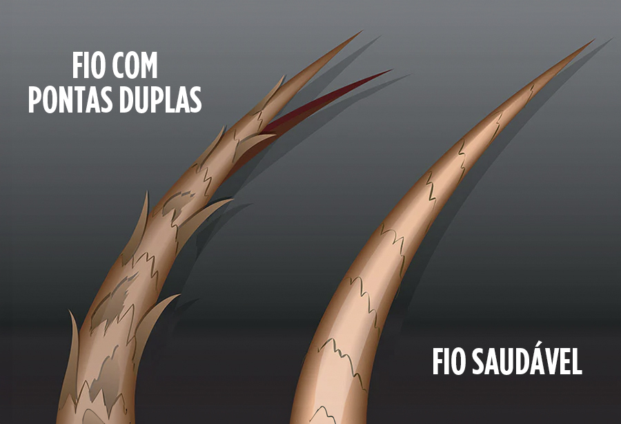 tratamento para pontas duplas